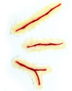 Protesi in lattice taglio superficiale